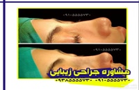 جراحی بینی در کرمان