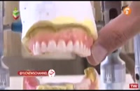 ساخت دندان مصنوعی