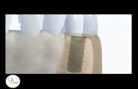 ویدیو انیمیشن کاشت ایمپلنت دندان