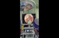 عمل جراحی دکتر رضا اشراقی با دوربین پزشکی Surgical Camera