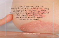 مهمترین علائم اگزمای پوستی و‌روش قطعی درمان آن