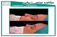 عمل جراحی زیبایی بینی در کرمان