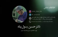 دکتر حسین رسول پناه جراح بینی
