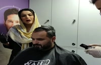 کاشت مو استثنایی مراجعه کننده عزیز کلینیک vip تهران