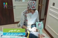 روکش دندان کودک در تهران