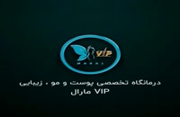 توضیحات دکتر نصیری درباره لیفت شقیقه و لیفت ابرو-کلینیک vip تهران