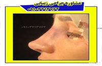 عمل جراحی زیبایی در مشهد