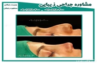 عمل جراحی زیبایی بینی در یزد