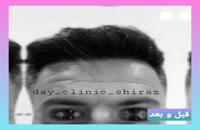 کلینیک تخصصی کاشت ریش در تهران