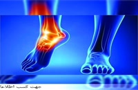 درمان گیاهی پا درد و ضعف های عضلانی