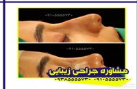 جراحی زیبایی بینی در همدان