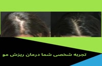 درمان طبیعی و تضمینی ریزش مو و رویش مجدد مو