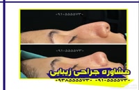 جراحی زیبایی بینی در بندر عباس