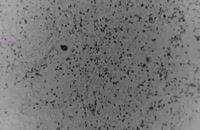 تصویر میکروسکوپی از ساختار ویروس کرونا