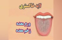 بیماری‌ ها از رنگ زبان
