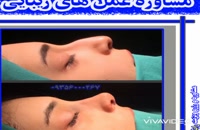 جراح زیبایی بینی در یزد