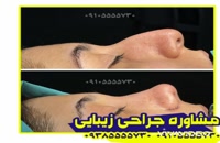 جراح زیبایی بینی در کرمان