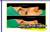 جراحی بینی در بندر عباس
