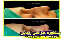 جراح زیبایی بینی در بندر عباس
